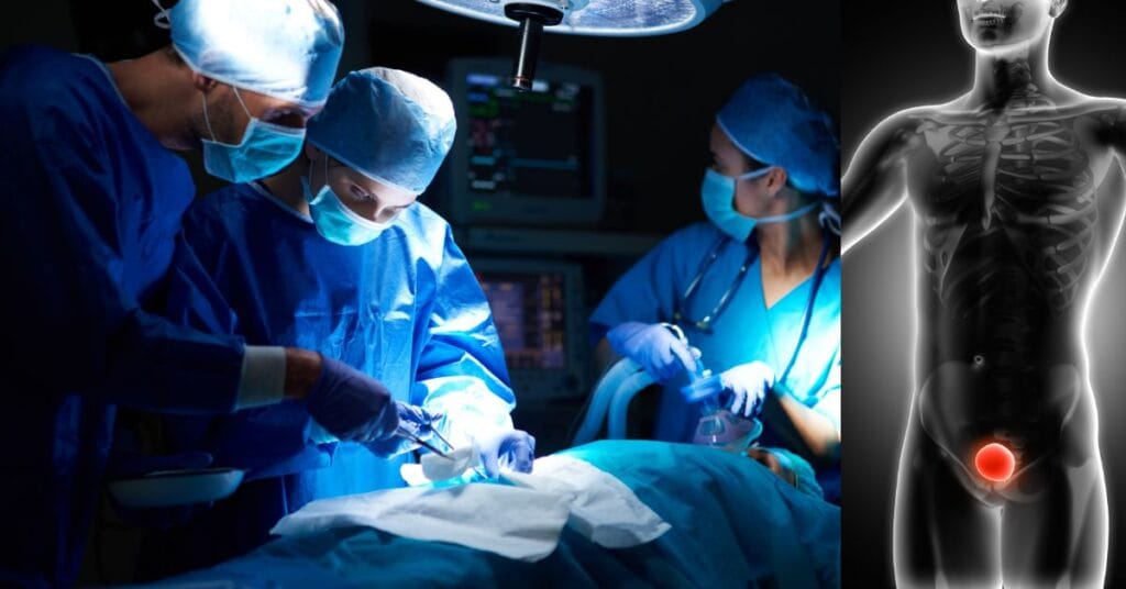 human bladder transplant