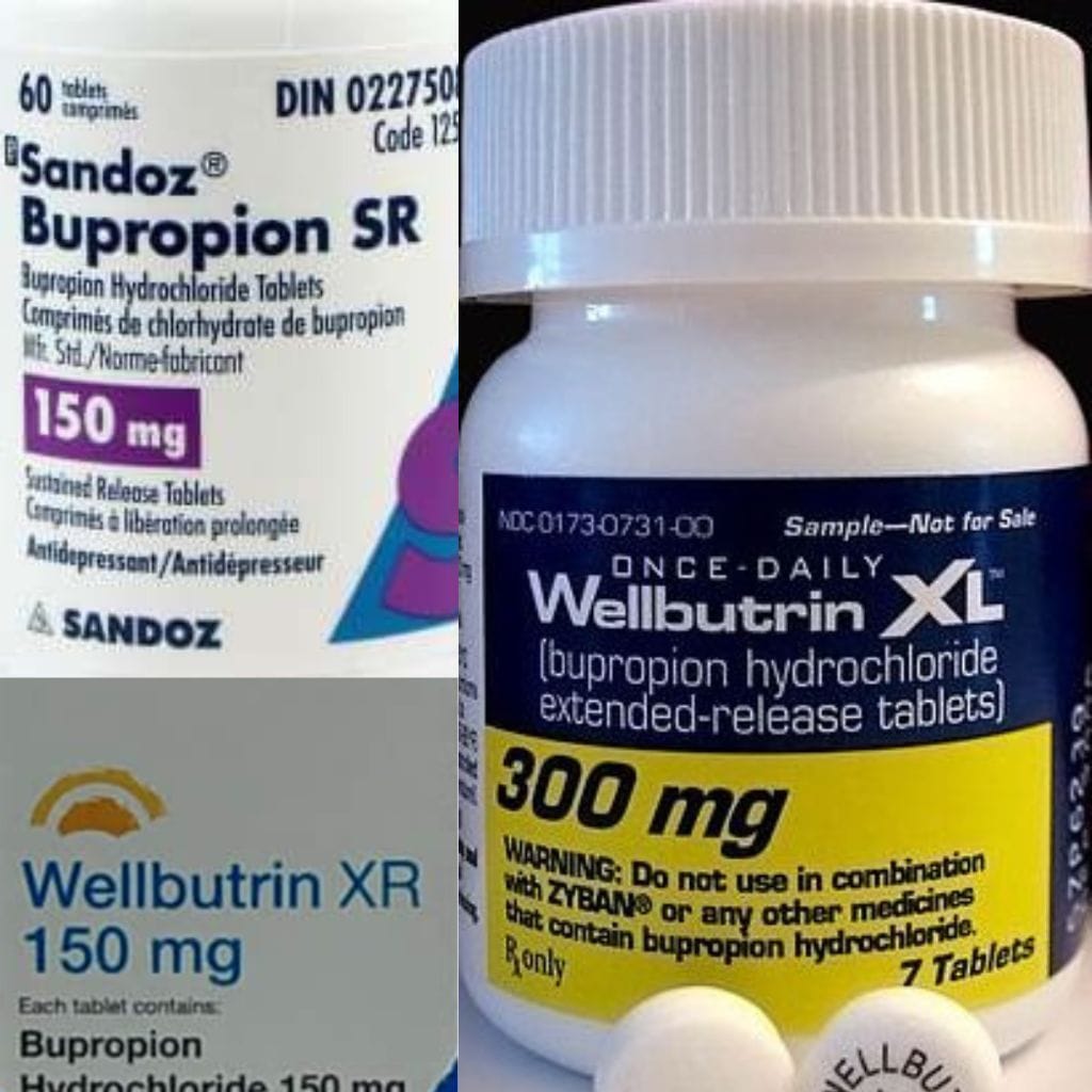 does wellbutrin help with weight loss